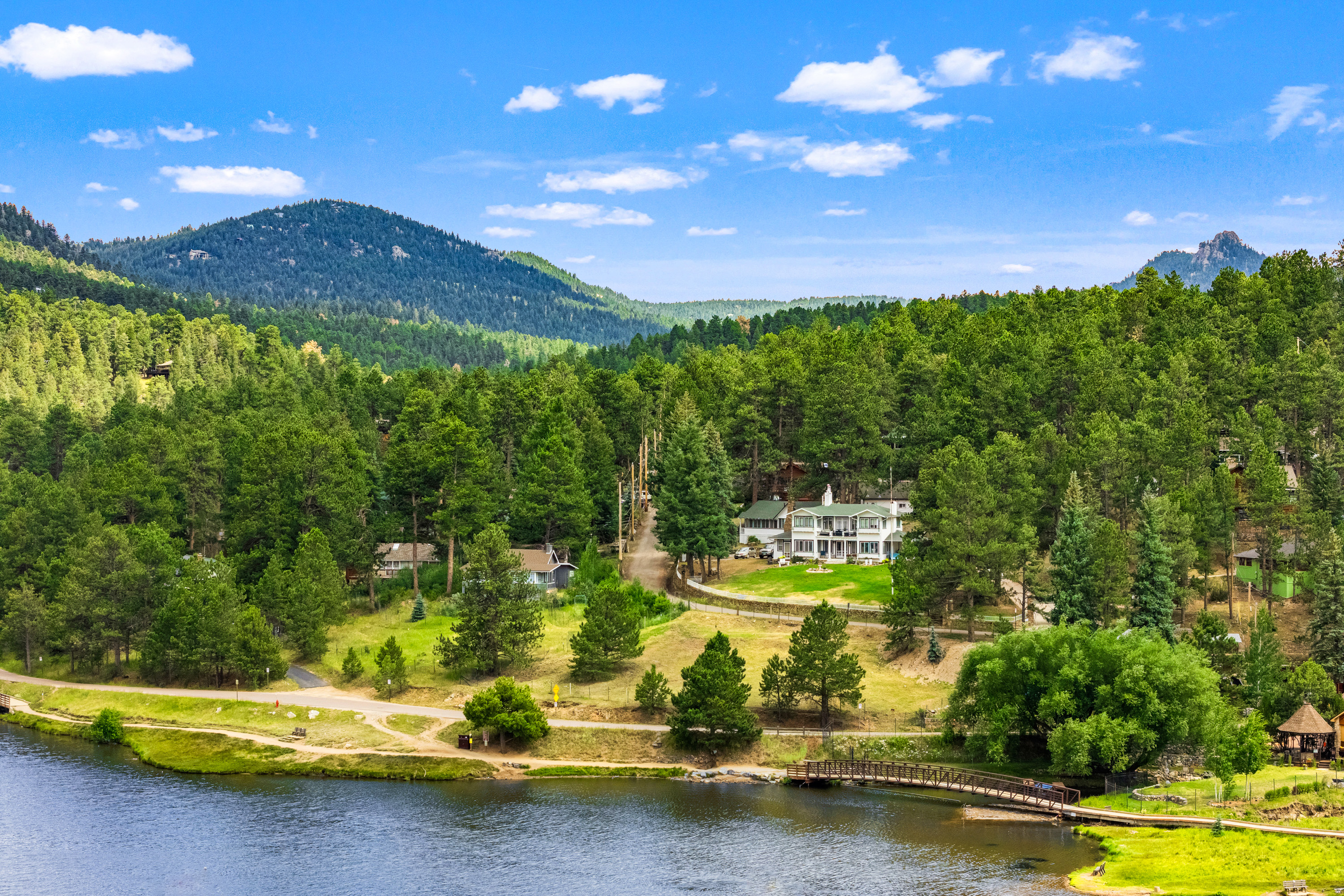  Rare Opportunity to Own 2 Homes Just Steps Away from Coveted Evergreen Lake - 物件實景